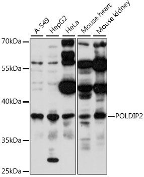 Western blot