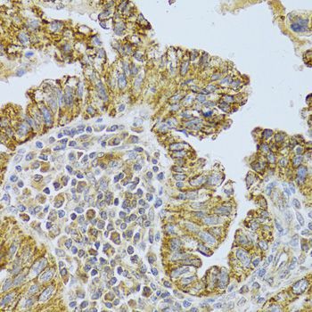 Immunohistochemistry - DLD Antibody (144-05403)
