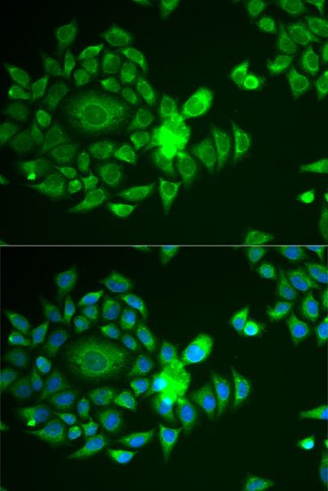 Immunofluorescence - NDUFS4 antibody (144-013519)