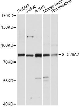 Western blot - SLC26A2 antibody (144-60708)