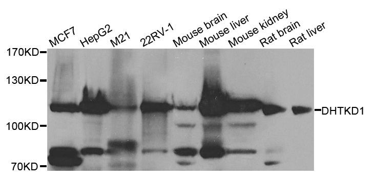 Western blot - DHTKD1 antibody (144-08369)