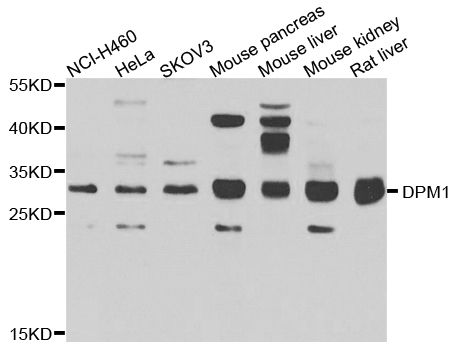 Western blot - DPM1 antibody (144-07757)