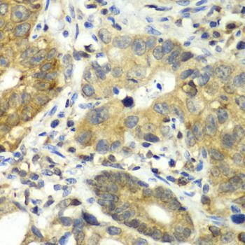 Immunohistochemistry - DPP3 antibody (144-60318)