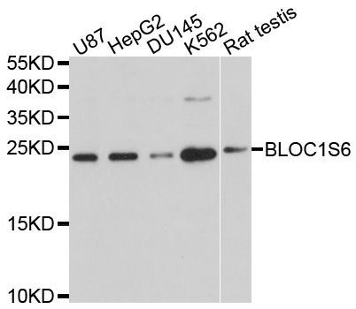 Western blot - BLOC1S6 antibody (144-04620)