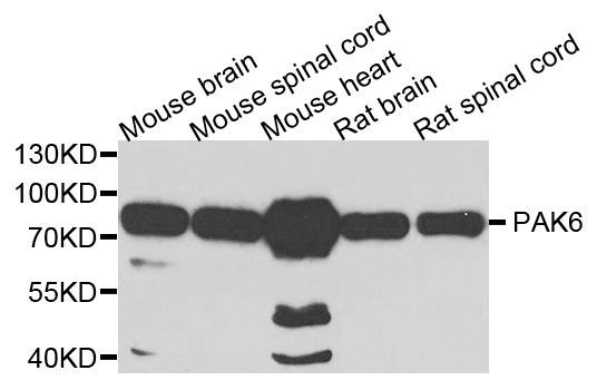 Western blot - PAK6 antibody (144-07821)
