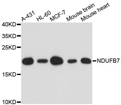 Western blot - NDUFB7 antibody (144-60447)