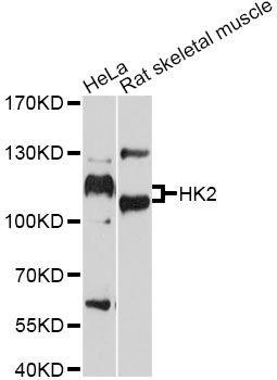 Western blot - HK2 Polyclonal Antibody (144-00994)