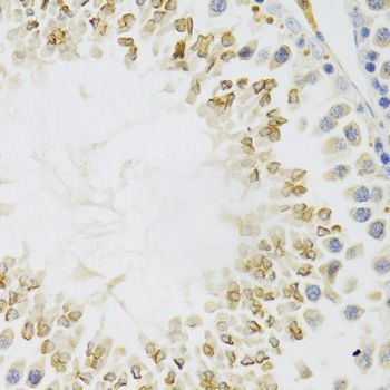 Immunohistochemistry - GEMIN2 Antibody (144-03082)