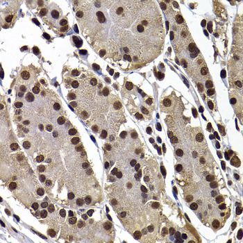 Immunohistochemistry - GPS1 Polyclonal Antibody (144-06917)