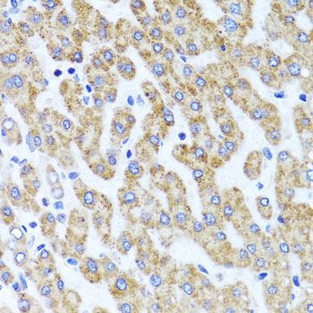 Immunohistochemistry - INADL antibody (144-08476)