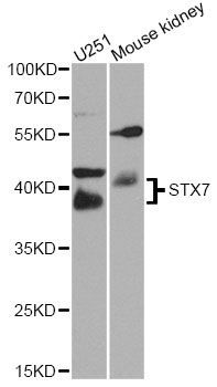 Western blot - STX7 antibody (144-08057)