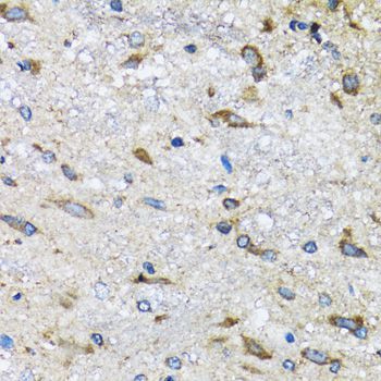 Immunohistochemistry - BLZF1 Polyclonal Antibody (144-06430)