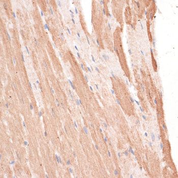 Immunohistochemistry - KIF1C antibody (144-015786)