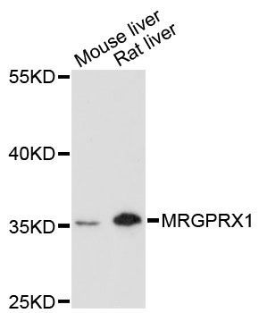 Western blot - MRGPRX1 antibody (144-60211)