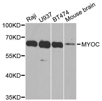 Western blot - MYOC antibody (144-01589)