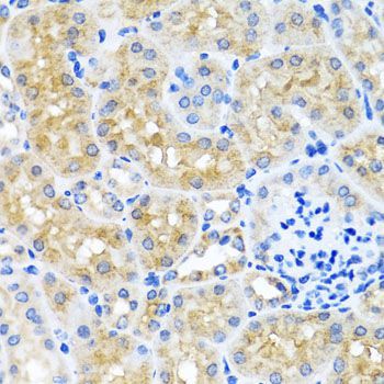 Immunohistochemistry - SCO1 antibody (144-06734)