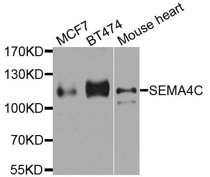 Western blot - SEMA4C antibody (144-08225)
