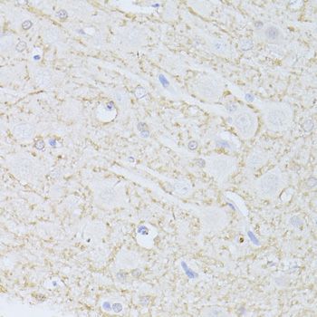 Immunohistochemistry - PHGDH Polyclonal Antibody (144-10461)