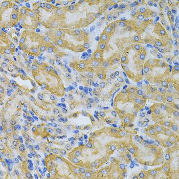 Immunohistochemistry - PGK1 Antibody (144-60560)