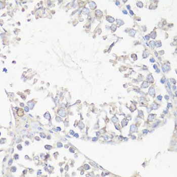 Immunohistochemistry - MAP1LC3B Polyclonal Antibody (144-11282)