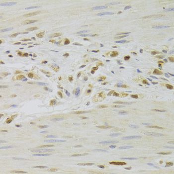 Immunohistochemistry - PRPF3 Polyclonal Antibody (144-05482)