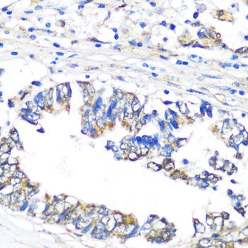 Immunohistochemistry - NAMPT Polyclonal Antibody (144-00256)
