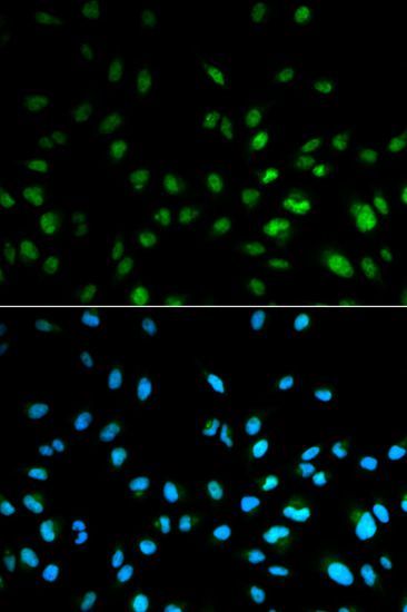 Immunofluorescence - HDAC3 Polyclonal Antibody (144-02139)