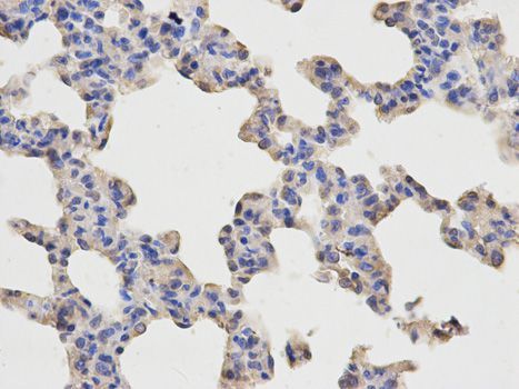Immunohistochemistry - RELA Polyclonal Antibody (144-02547)