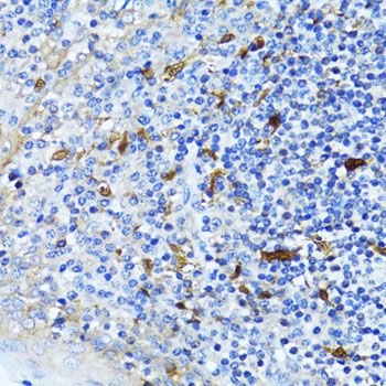 Western blot - CTNNB1 Polyclonal Antibody (144-011512)
