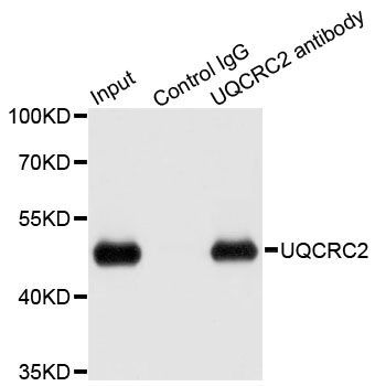 Immunohistochemistry - UQCRC2 Polyclonal Antibody (144-04181)