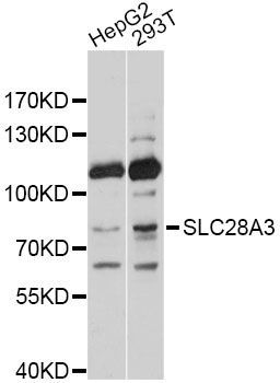 Western blot - SLC28A3 Polyclonal Antibody (144-010320)