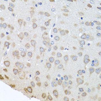 Immunohistochemistry - PABPC4 antibody (144-05948)