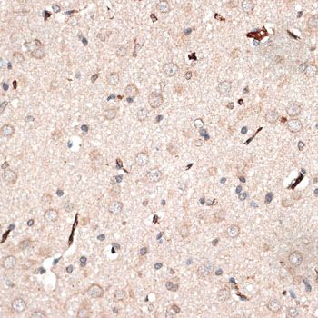 Immunohistochemistry - KTN1 antibody (144-012456)