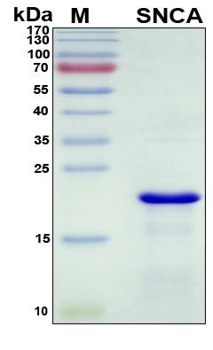SDS-PAGE