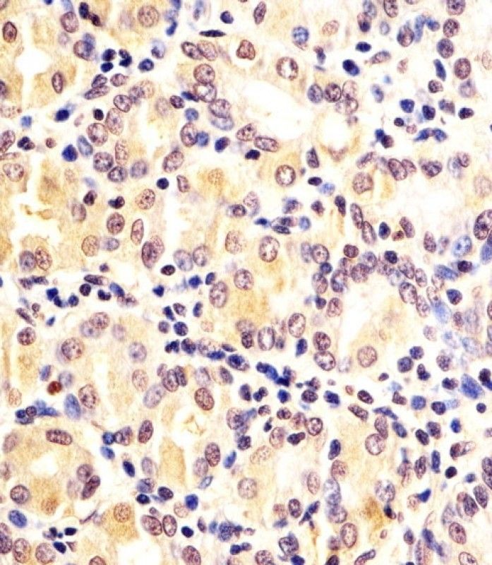 IHC-P