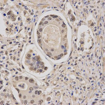Immunohistochemistry - CBFB Antibody (144-05305)
