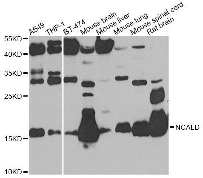 Western blot - NCALD Polyclonal Antibody (144-08000)