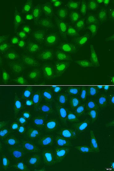 Immunofluorescence - Histone H3 Polyclonal Antibody (144-02348)