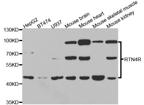 Western blot - RTN4R antibody (144-05847)