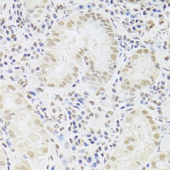 Immunohistochemistry - SNRPA Antibody (144-06410)