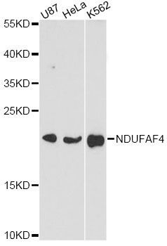 Western blot - NDUFAF4 antibody (144-60643)
