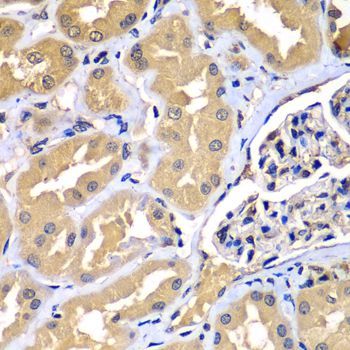 Immunohistochemistry - WIPI2 Polyclonal Antibody (144-07537)