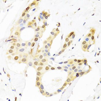 Immunohistochemistry - [KO Validated] SUZ12 Polyclonal Antibody (144-07786)