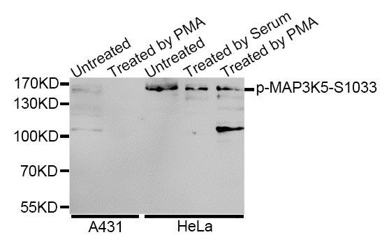 Western blot - Phospho-MAP3K5-S1033 antibody (144-50058)