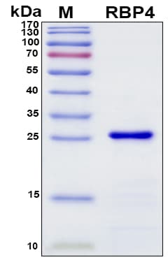 SDS-PAGE Image