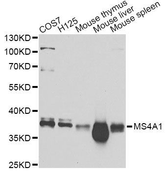 Western blot - MS4A1 Antibody (144-01793)