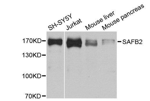 Western blot - SAFB2 antibody (144-04330)