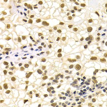 Immunohistochemistry - DDB1 Polyclonal Antibody (144-02896)