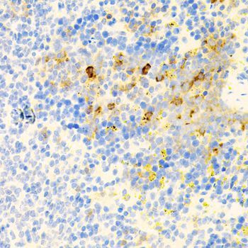 Immunohistochemistry - PROK2 antibody (144-06705)