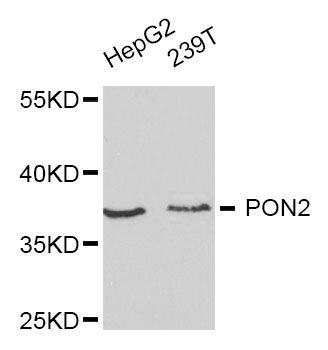 Western blot - PON2 Polyclonal Antibody (144-01646)